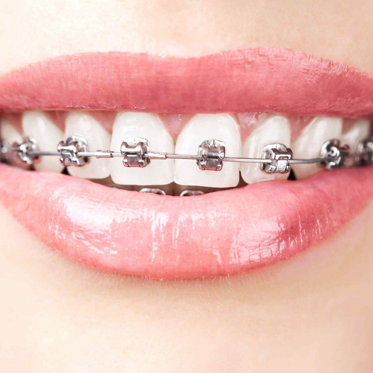https://krishdentalcare.com/wp-content/uploads/2020/01/post-03-1280x1280.jpg