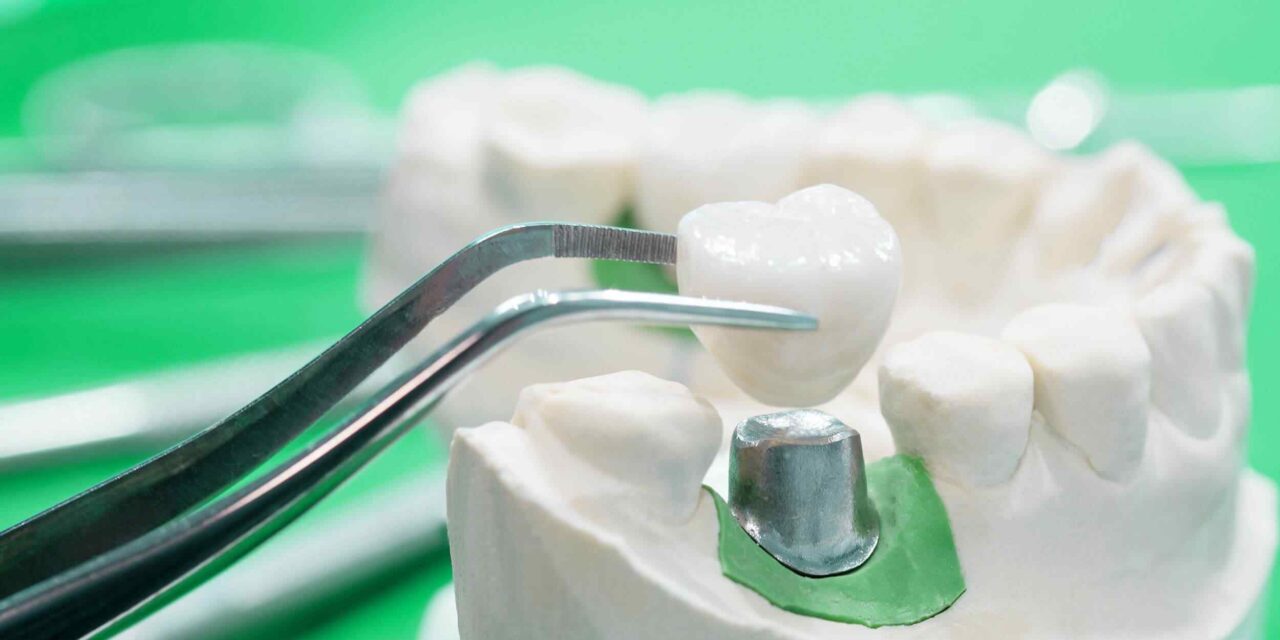 https://krishdentalcare.com/wp-content/uploads/2020/01/post-28-1280x640.jpg